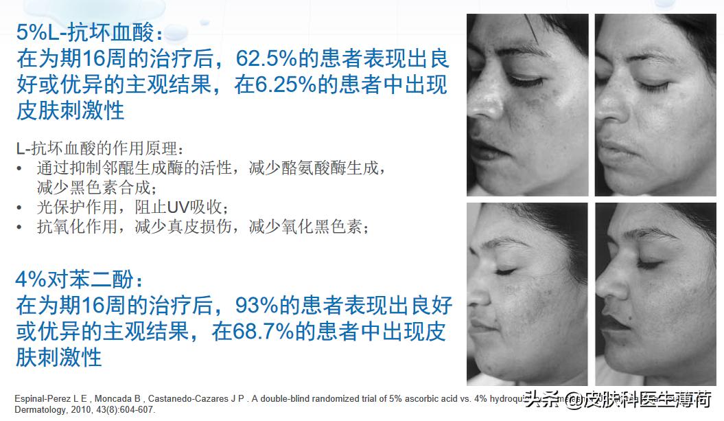 黄脸婆吃什么祛斑,告别黄脸婆自制纯中药祛斑面膜