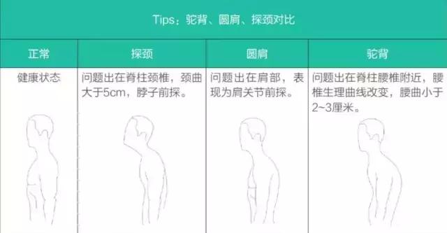 半个娱乐圈都有的体态问题——探颈，元新手把手教你矫正