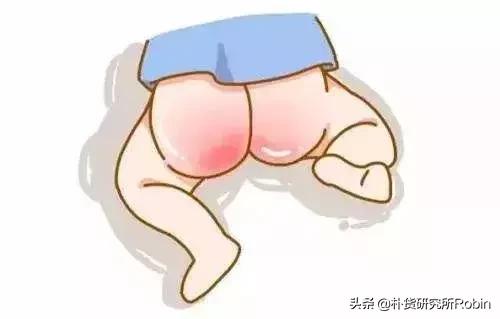 宝宝换季皮肤问题多妈妈怎么办,宝宝夏季皮肤问题