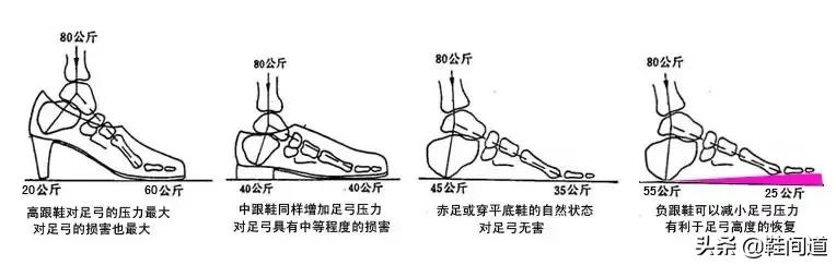 足弓对人体的影响｜脚型对鞋子的要求（附：选购建议）