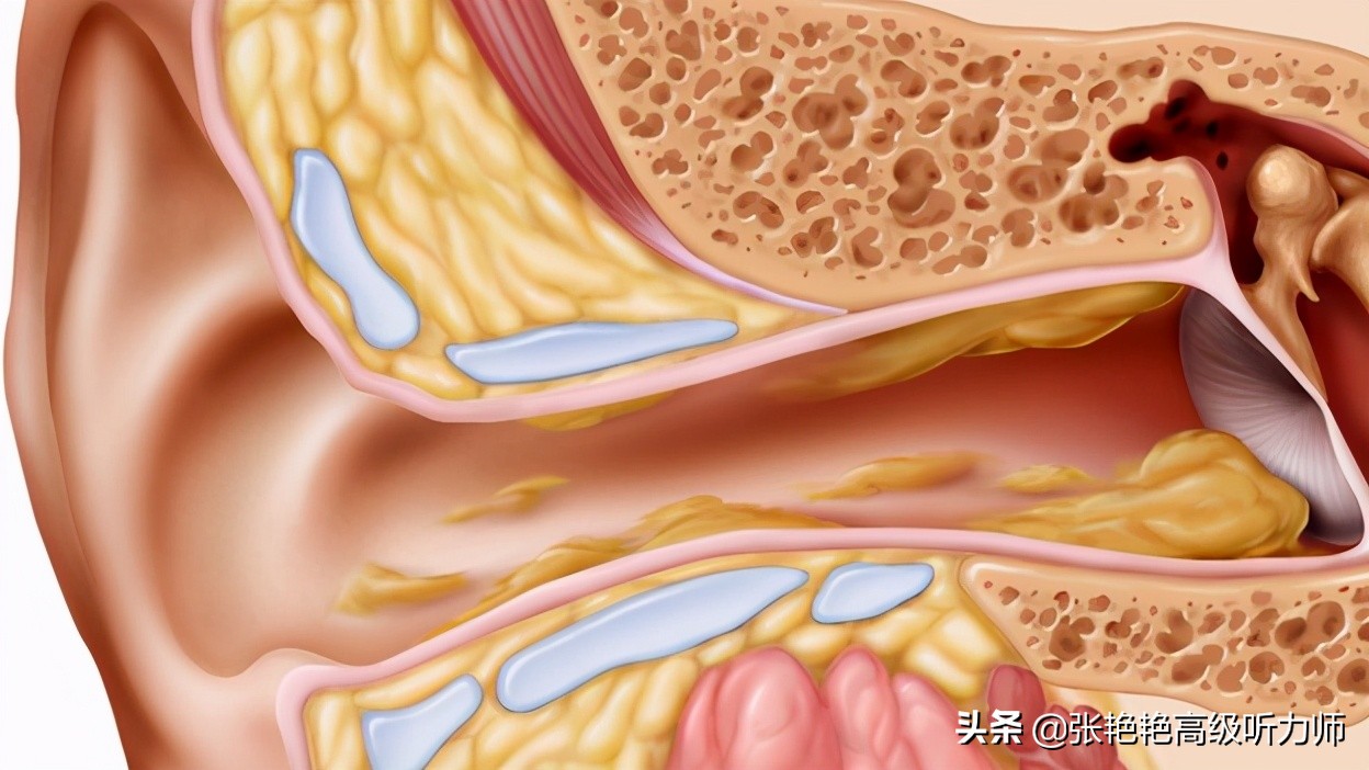 为什么有人耳朵流油,为什么耳朵老是油油的