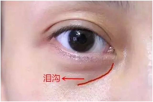 如何让泪沟消失小技巧,泪沟真的毫无办法吗
