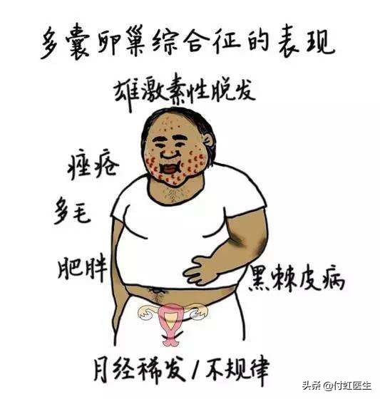 16岁月经紊乱、脱发、*疮痤**、面貌变丑，原来是这个病在作怪