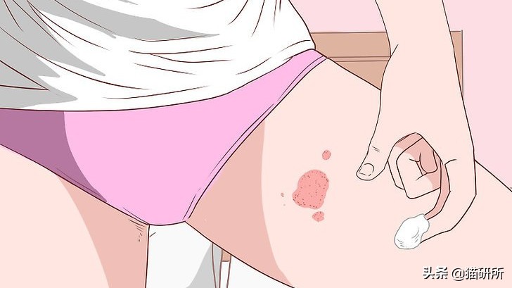 铲屎官得了猫癣怎么处理,铲屎官必知猫咪急救办法