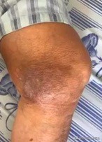 膝关节疼痛贴药贴贴在什么位置,关节疼痛贴膝盖贴管用吗