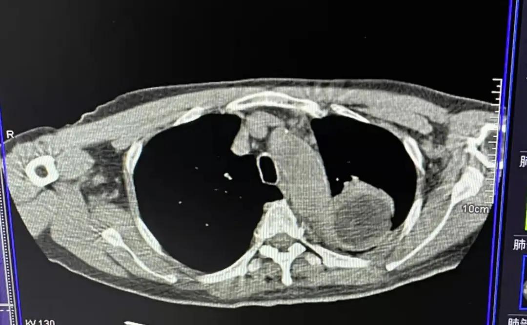 重庆大学附属肿瘤医院肿瘤内科,重庆大学附属肿瘤医院项目