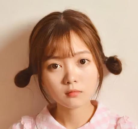 婴儿脸长怎么改善,婴儿肥脸怎么治疗