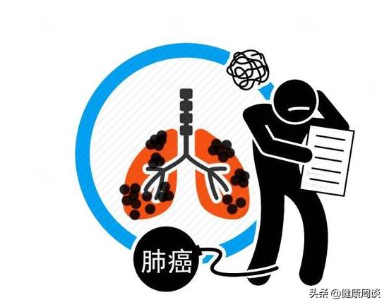 手指变粗肺癌前兆,手指关节变粗是肺癌吗