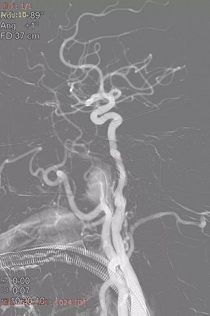 山西省人民医院任少华教授,山西省人民医院任少华