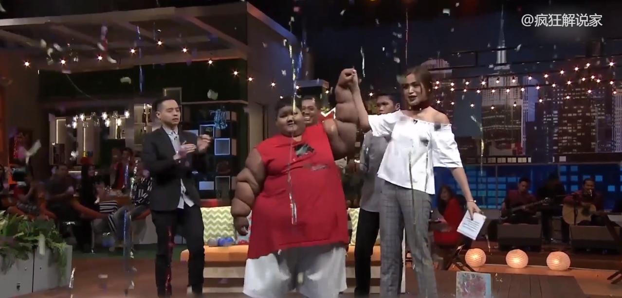 印尼最胖男孩减重200斤,印尼小胖墩