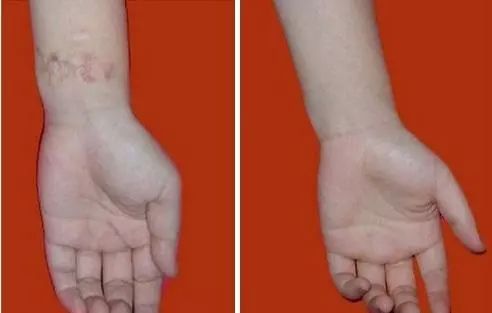 那些成长的记忆幸福的回忆,那些成长路上的伤痛与磨难