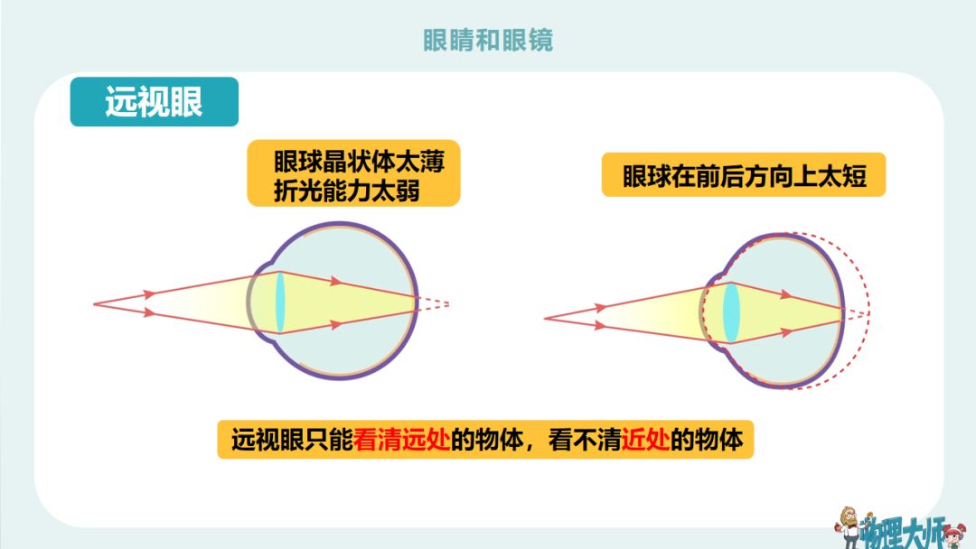 初二物理眼睛与眼镜难题,初二物理眼睛与眼镜讲解视频
