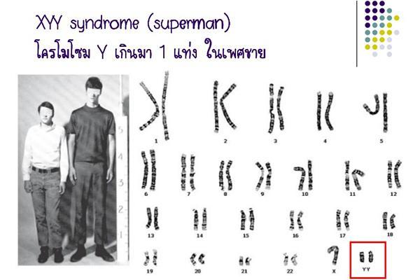 判断犯罪者的面相,面相判断犯罪人的标准有哪些