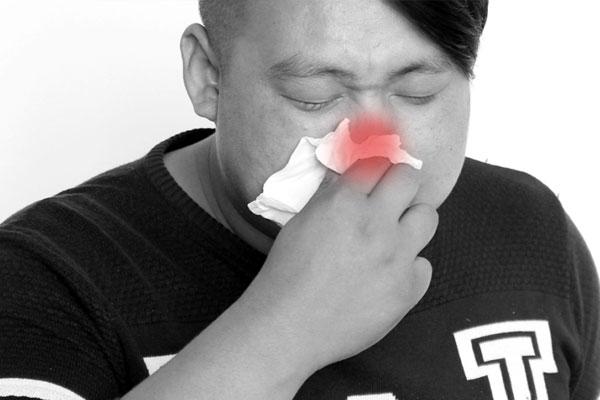 窜出来的鼻毛能剪吗,不小心把鼻毛揪下来会怎么样