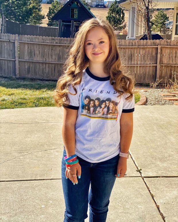 唐氏综合症少女模特,唐氏综合征女孩被美国收养