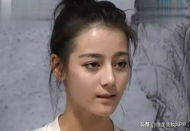 最常见的2种黑眼圈你中招了吗,黑眼圈分三种你都知道吗