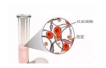 男科周强,周强医师