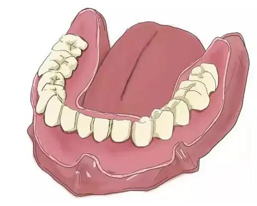 传统的种植牙和即刻种牙的区别,什么是种牙方法