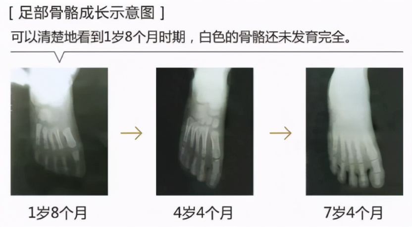 塑料拖鞋导致孩子早熟,宝宝拖鞋怎么选择对宝宝脚好