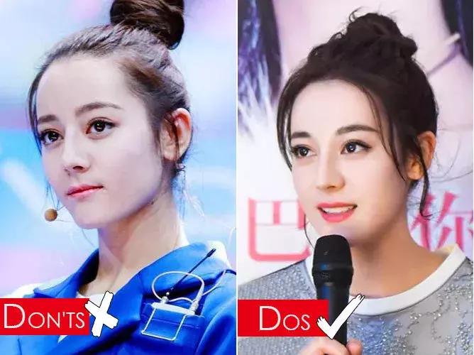 拯救发际线告别大额头,拯救发际线不走冤枉路