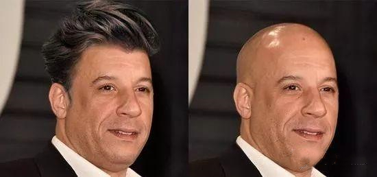 街机游戏的那些秃子，掉头发原因千奇百怪，你还记得天安神童吗？