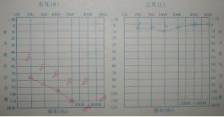 全国爱耳日的坏处,爱耳日听力下降了