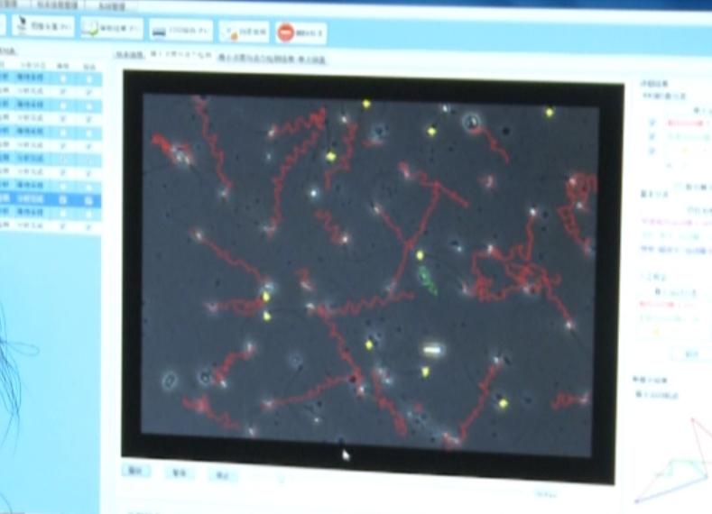 蚌埠一附院试管婴儿畸形,蚌埠首例试管婴儿