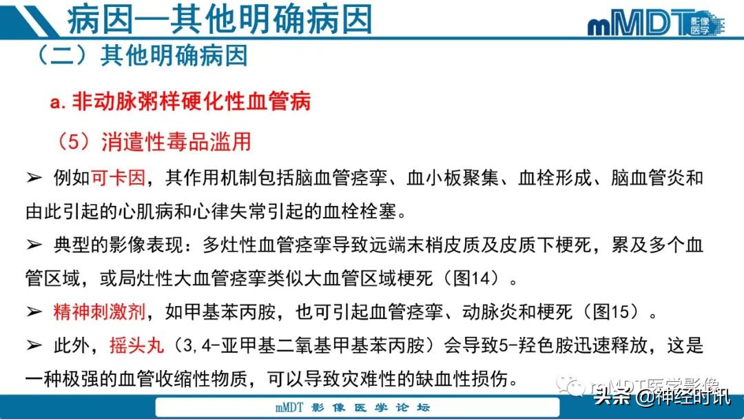 缺血性脑卒中护理课件,缺血性脑卒中讲课ppt