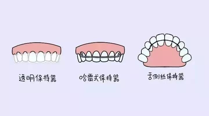 话不多说保持器大盘点来了