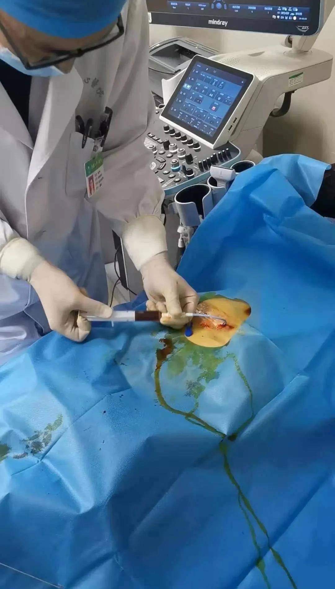 *安泰**市中心医院肝胆外科副主任医师刘阳：“肝胆相照”彰显医者仁心方寸之间演绎“镜下乾坤”