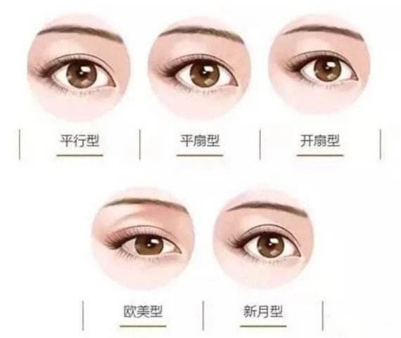 6.5毫米的双眼皮自然么,埋线双眼皮多久能恢复自然