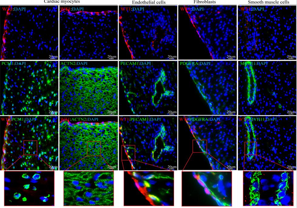 南大二附院心内科联合培养博士袁平在Circulation发文
