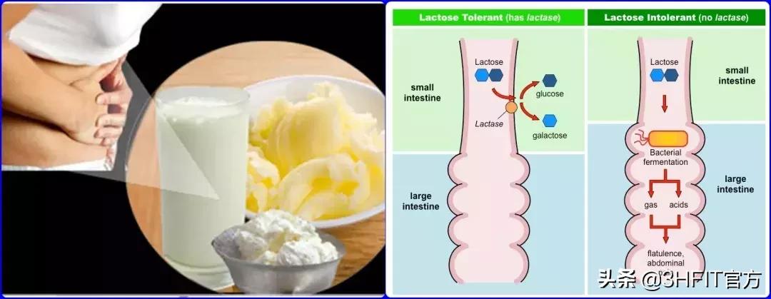 乳糖不耐受怎样才能正确判断,乳糖不耐受一般是什么情况引起的