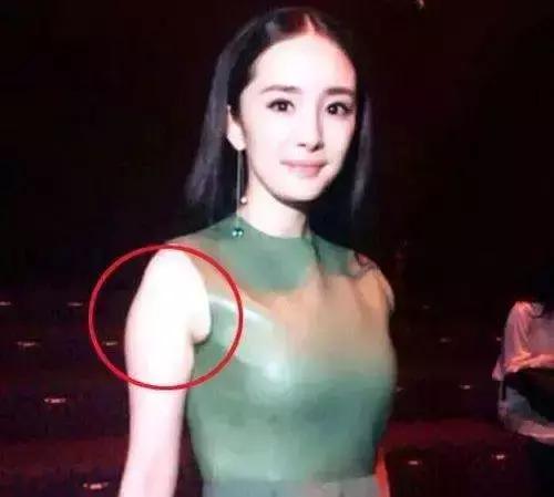 超模收副乳,超模消除副乳