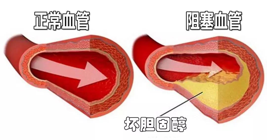 糖尿病控制好血糖的意义,糖尿病控制好的概率