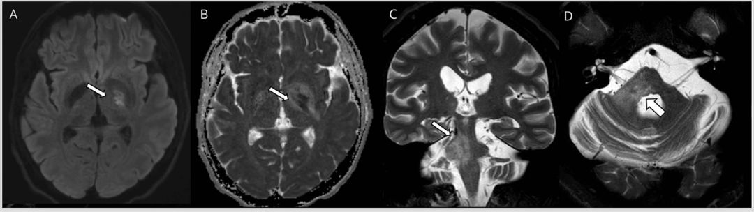 一文读懂13种最常见癌症筛查攻略,一文读懂5大慢性炎症检测项目