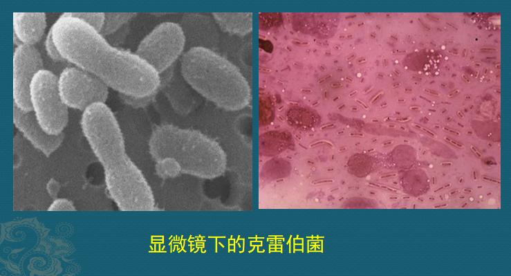 糖尿病人不要犟，有1种细菌喜欢喝糖浆，感染眼睛会失明