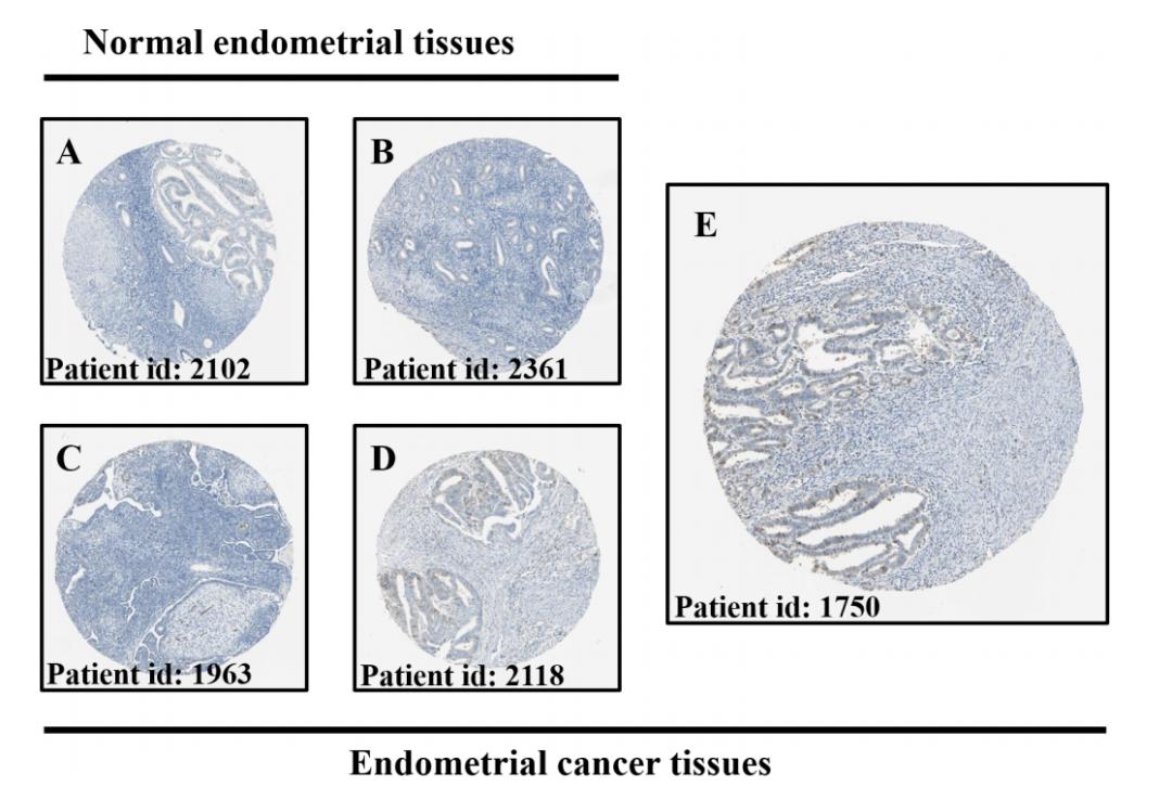 研究一个基因的方法有哪些,如何找到值得研究的基因