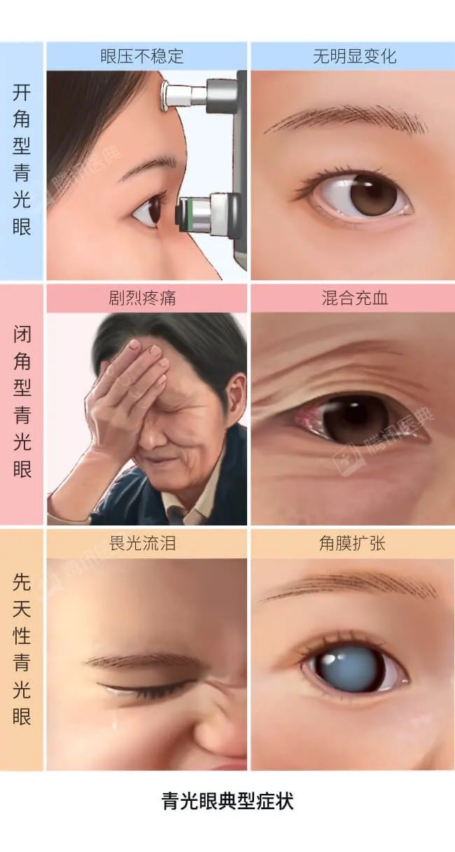 熬夜眼睛变红后,很多人都爱做这1件事,但其实更伤眼!