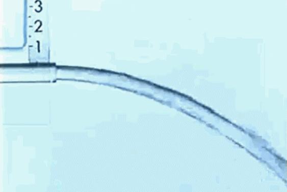 憋着没有放出的屁都去哪了,憋住不放的屁为啥还会来