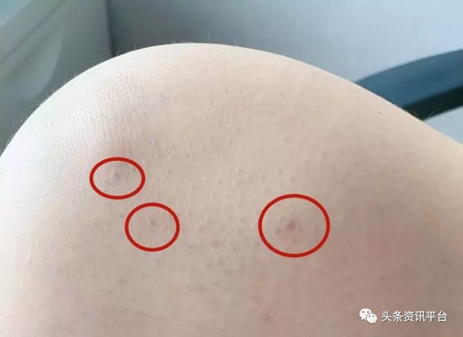 千谷德国溶脂线官网,千谷生物科技减肥