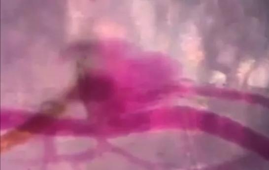 显微镜下的蚊子嘴巴,显微镜下的蚊子吸血全过程