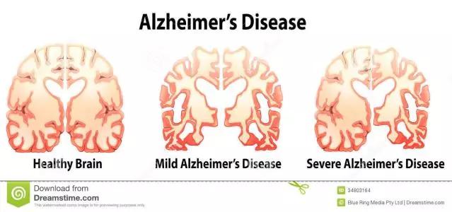 骨科专家说久坐不动的危害,久坐对骨科危害