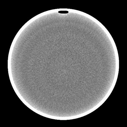 ct图像解析大全,ct图像与实物大小对比