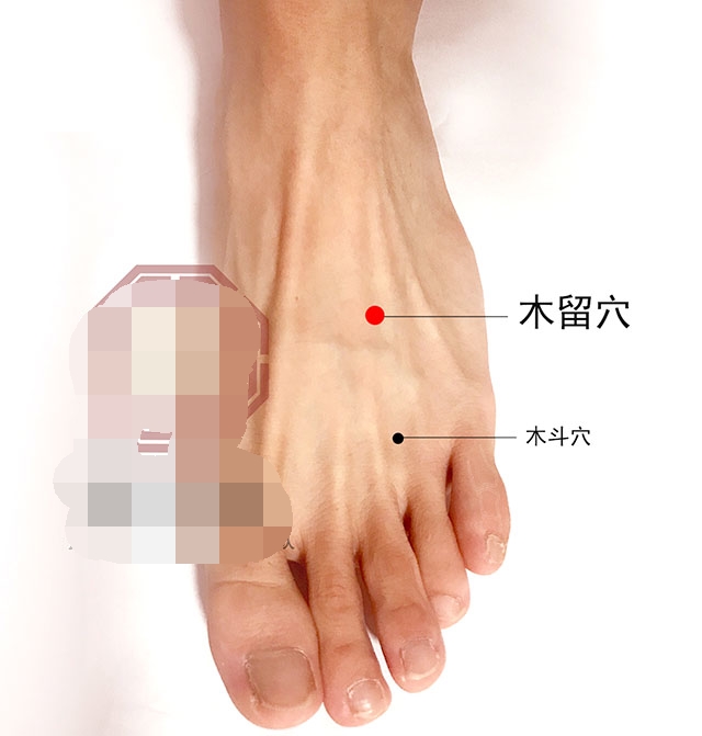 中医针灸耳朵疾病配穴处方,针灸耳朵可以治疗哪些病