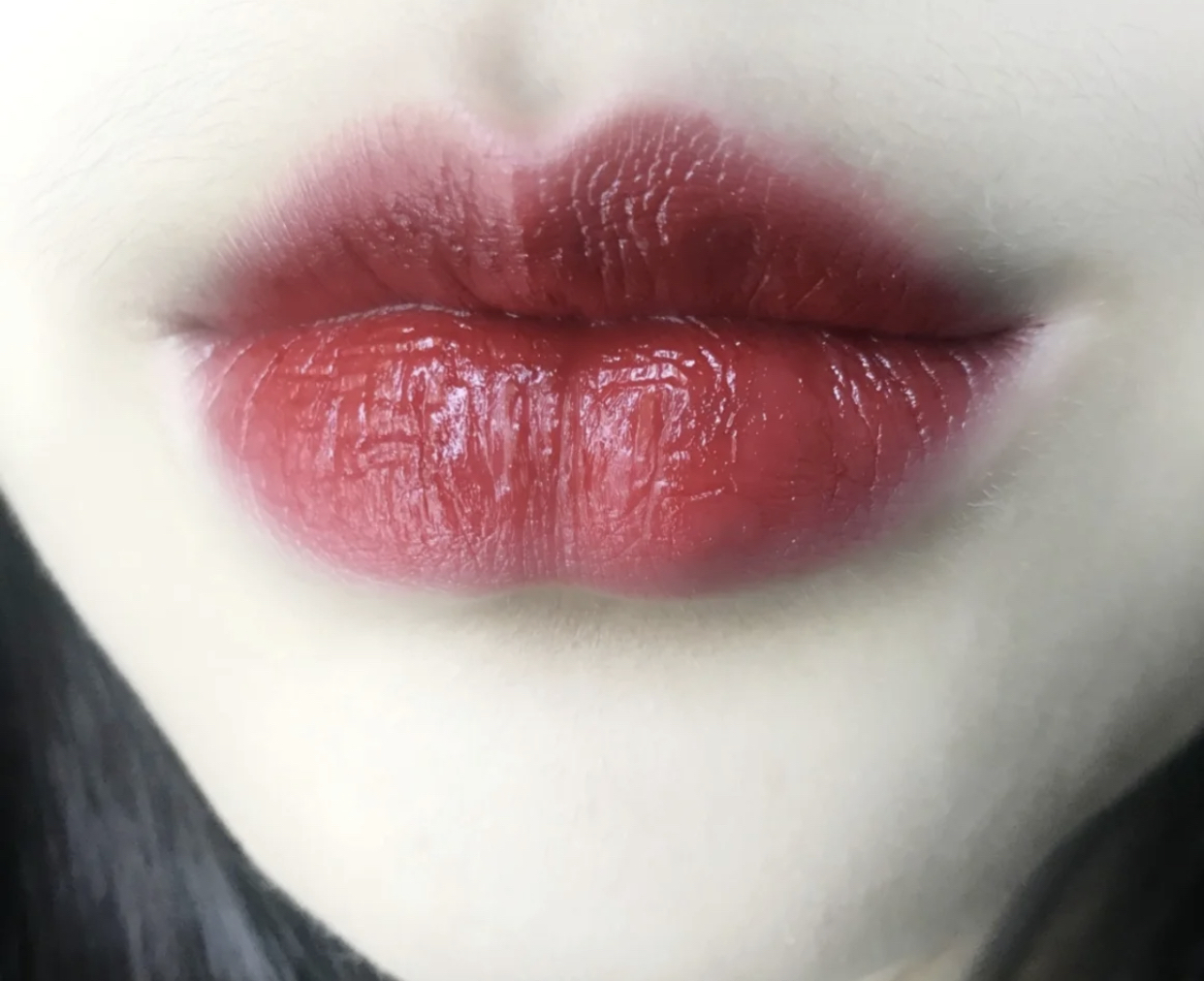 嘴唇经常又干又起皮是什么原因,嘴唇黑紫起干皮用什么