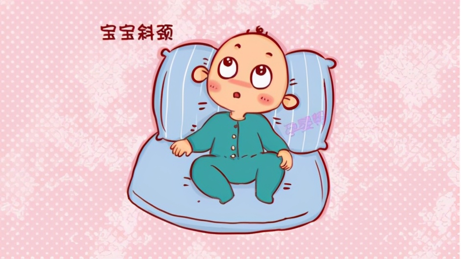 四月龄宝宝习惯性斜颈怎么纠正,儿童习惯性斜颈矫正手法视频