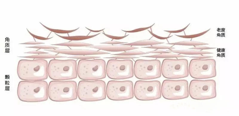 如何有效的去角质,去角质方法长期不去角质会怎样