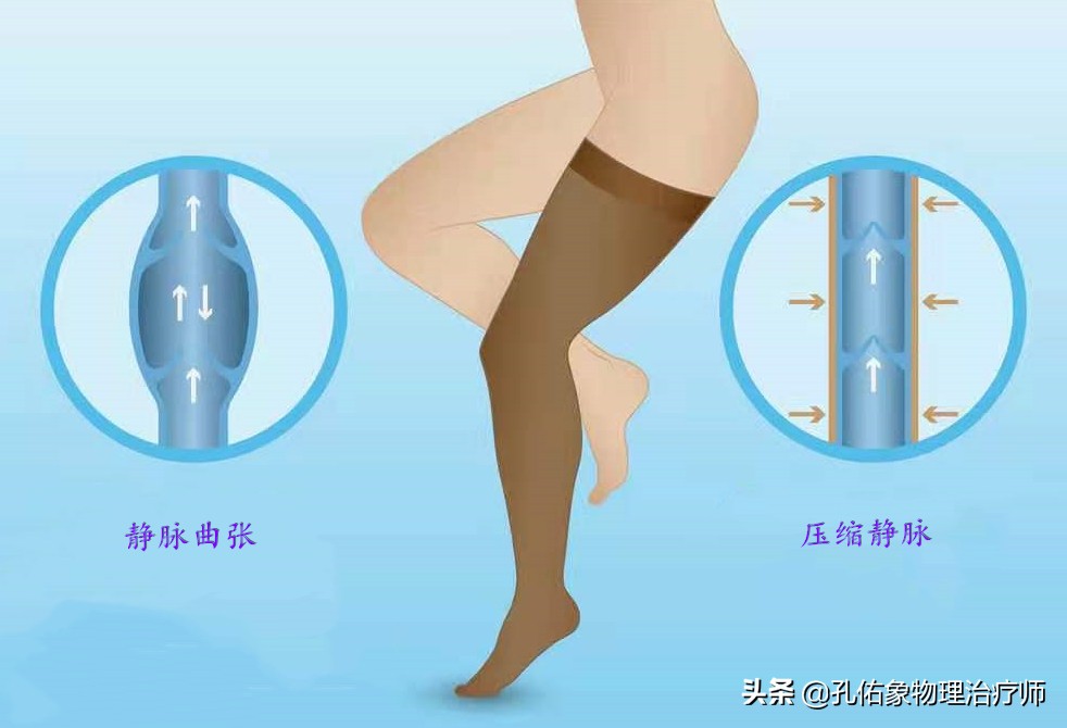 腿上细血管像蜘蛛样怎么回事,小腿上的血管像小蚯蚓一样