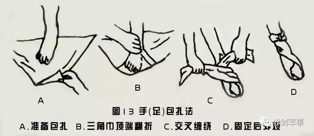 军队三角巾包扎法视频,部队卫生与救护三角巾包扎方法